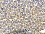 CYP2E1 Antibody in Immunohistochemistry (Paraffin) (IHC (P))