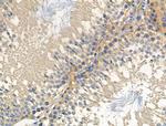 C1QBP Antibody in Immunohistochemistry (Paraffin) (IHC (P))