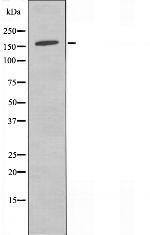 SOS2 Antibody in Western Blot (WB)