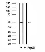 RAD23B Antibody in Western Blot (WB)