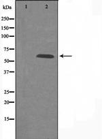 GPR101 Antibody in Western Blot (WB)