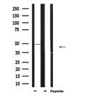 Arp3 Antibody in Western Blot (WB)