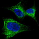 Nestin Antibody in Immunocytochemistry (ICC/IF)