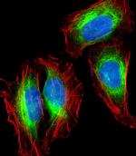 Nestin Antibody in Immunocytochemistry (ICC/IF)