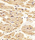 Nestin Antibody in Immunohistochemistry (Paraffin) (IHC (P))