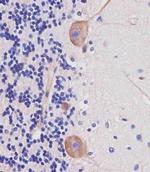 Nestin Antibody in Immunohistochemistry (Paraffin) (IHC (P))