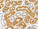 PCK1 Antibody in Immunohistochemistry (Paraffin) (IHC (P))