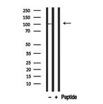 BCAM Antibody in Western Blot (WB)