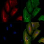 KLHL3 Antibody in Immunocytochemistry (ICC/IF)