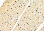 KLHL3 Antibody in Immunohistochemistry (Paraffin) (IHC (P))