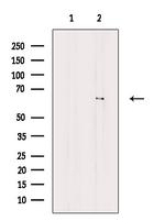 KLHL3 Antibody in Western Blot (WB)