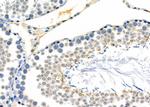 Alpha A Crystallin Antibody in Immunohistochemistry (Paraffin) (IHC (P))