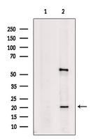 Alpha A Crystallin Antibody in Western Blot (WB)