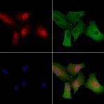 Ataxin 7 Antibody in Immunocytochemistry (ICC/IF)