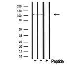 PDE2A Antibody in Western Blot (WB)