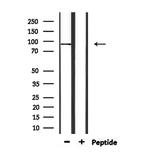 SAP102 Antibody in Western Blot (WB)