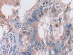 OAS2 Antibody in Immunohistochemistry (Paraffin) (IHC (P))