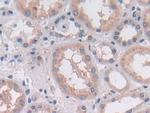 OAS2 Antibody in Immunohistochemistry (Paraffin) (IHC (P))