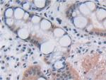 OAS2 Antibody in Immunohistochemistry (Paraffin) (IHC (P))