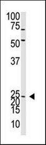 Neurogenin 2 Antibody in Western Blot (WB)