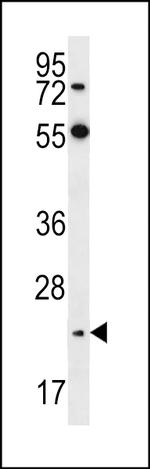 Neurogenin 2 Antibody in Western Blot (WB)