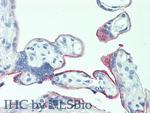 5T4 Antibody in Immunohistochemistry (Paraffin) (IHC (P))