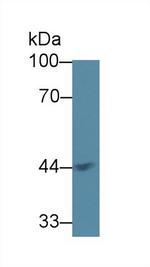 ACAA1 Antibody in Western Blot (WB)