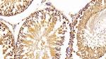 ACP1 Antibody in Immunohistochemistry (Paraffin) (IHC (P))