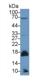 ACP1 Antibody in Western Blot (WB)