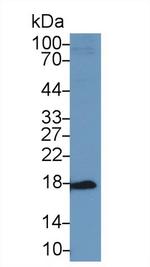 ACP1 Antibody in Western Blot (WB)