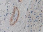 ACTG2 Antibody in Immunohistochemistry (Paraffin) (IHC (P))