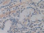 ACTG2 Antibody in Immunohistochemistry (Paraffin) (IHC (P))