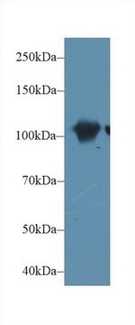 alpha Actinin 2 Antibody in Western Blot (WB)