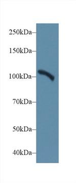 alpha Actinin 2 Antibody in Western Blot (WB)