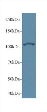 alpha Actinin 2 Antibody in Western Blot (WB)