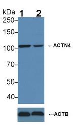 alpha Actinin 4 Antibody in Western Blot (WB)