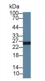 AK3 Antibody in Western Blot (WB)