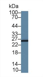 AK3 Antibody in Western Blot (WB)