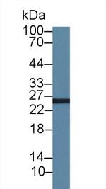 AK3 Antibody in Western Blot (WB)