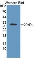 AK3 Antibody in Western Blot (WB)