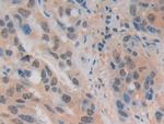 ADRM1 Antibody in Immunohistochemistry (Paraffin) (IHC (P))