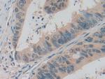 ADRM1 Antibody in Immunohistochemistry (Paraffin) (IHC (P))