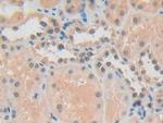 ADRM1 Antibody in Immunohistochemistry (Paraffin) (IHC (P))