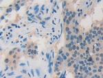 ADRM1 Antibody in Immunohistochemistry (Paraffin) (IHC (P))