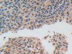 ADRM1 Antibody in Immunohistochemistry (Paraffin) (IHC (P))