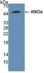 ADRM1 Antibody in Western Blot (WB)