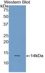 AgRP Antibody in Western Blot (WB)