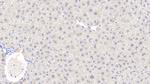 Alcohol Dehydrogenase 1A Antibody in Immunohistochemistry (Paraffin) (IHC (P))