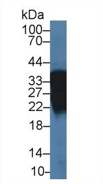 AK1BA Antibody in Western Blot (WB)