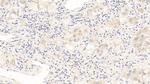 AFP Antibody in Immunohistochemistry (Paraffin) (IHC (P))